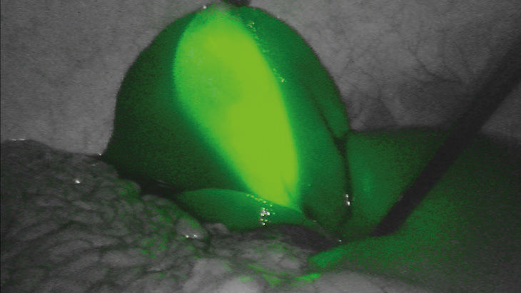 FI groen – 3D-fluorescentiebeeldvormingstechnologie