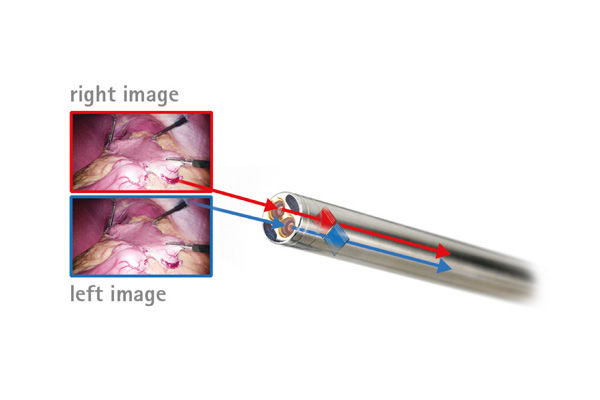 Voorbeeld van chip-on-the-tip 3D-camerasystemen