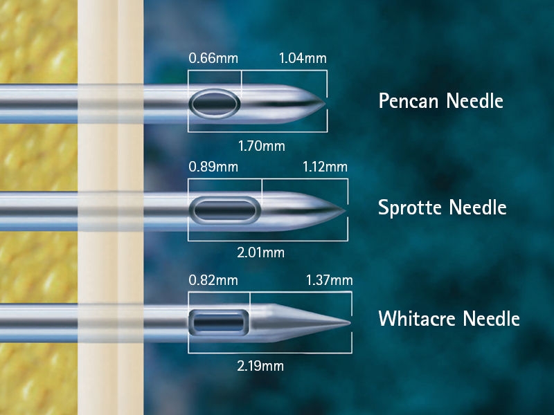 Illustratie die Pencan<sup>®</sup>-, Sprotte- en Whitacre-spinale naalden vergelijkt met gelabelde tipontwerpen en afmetingen in millimeters