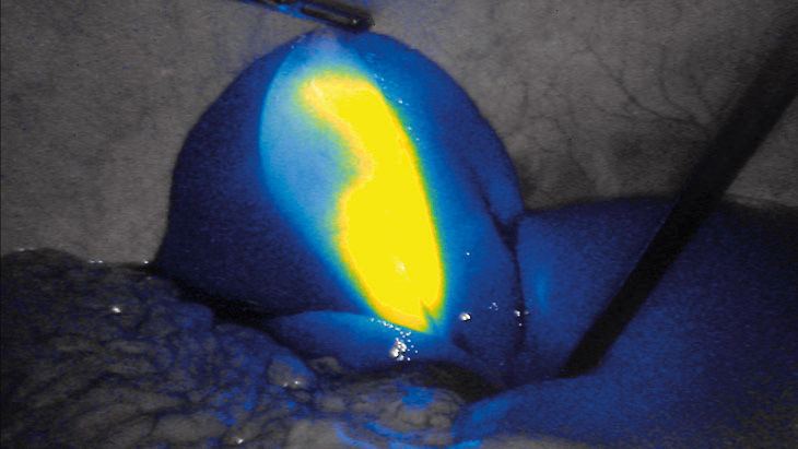 FI-intensiteit – 3D-fluorescentiebeeldvormingstechnologie