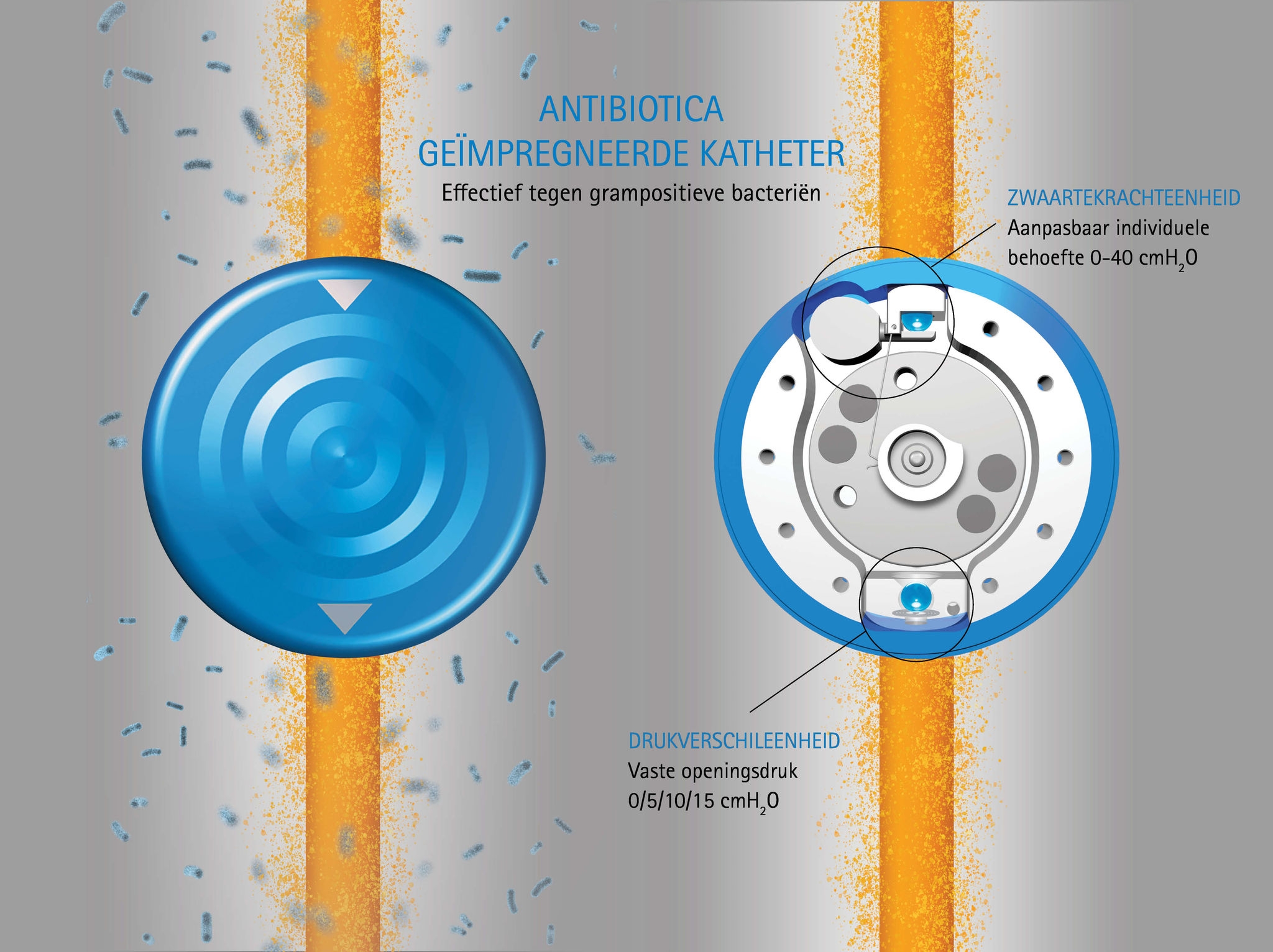 MIETHKE M.blue® gravitational valve – the next shunt generation