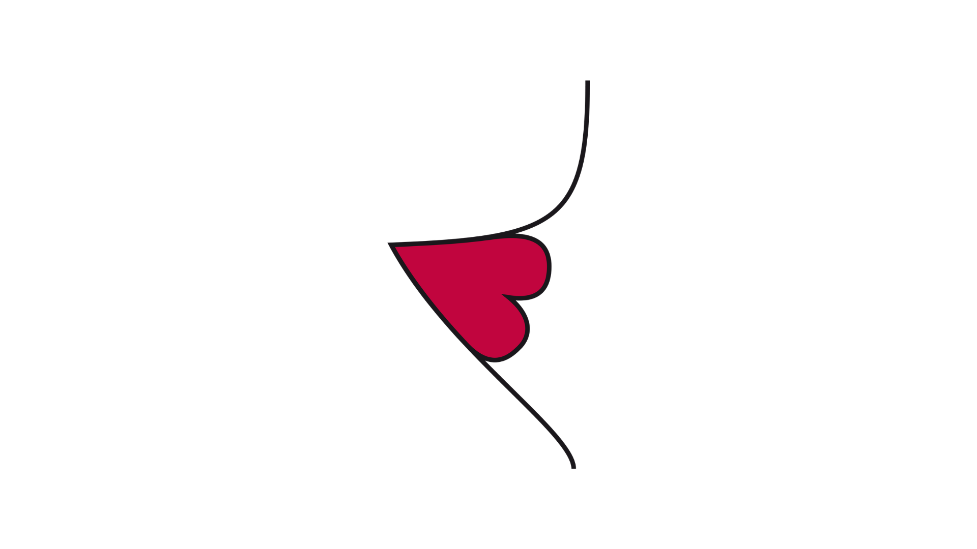 Schematische zijaanzichtillustratie van een ongunstig geplaatste stoma in een diepe huidplooi. De omliggende buikhuid vertoont een duidelijke plooi, waardoor de stoma zich in een oneffen huidoppervlak bevindt.