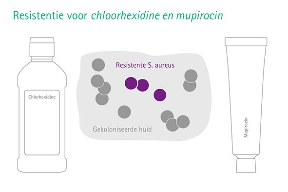 Chloorhexidine en mupirocin dekolonisatie